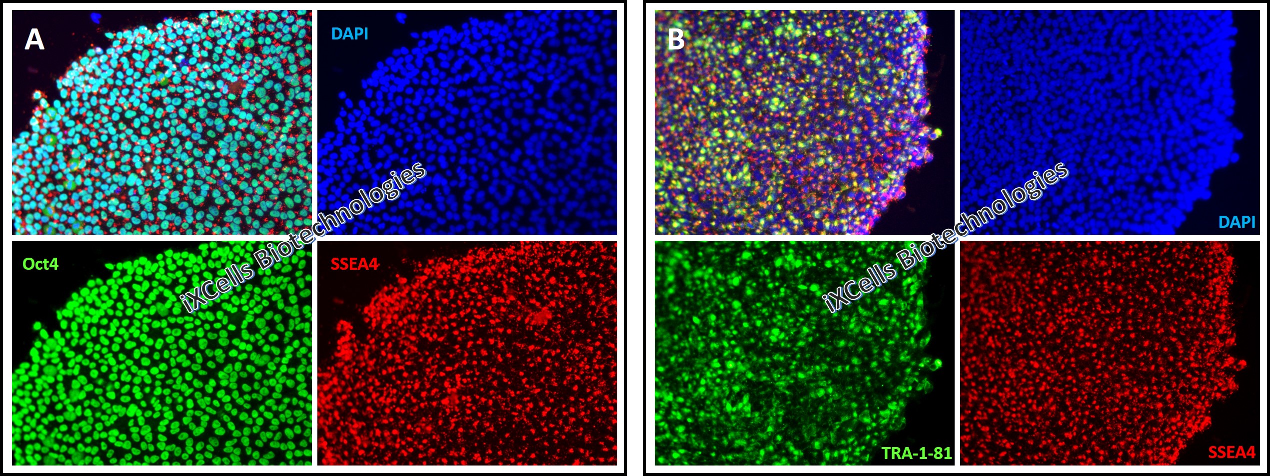 Human iPSC immunostaining